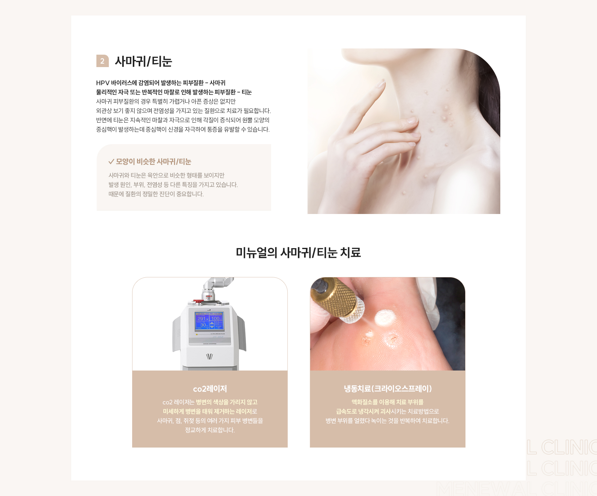피부질환 체크포인트