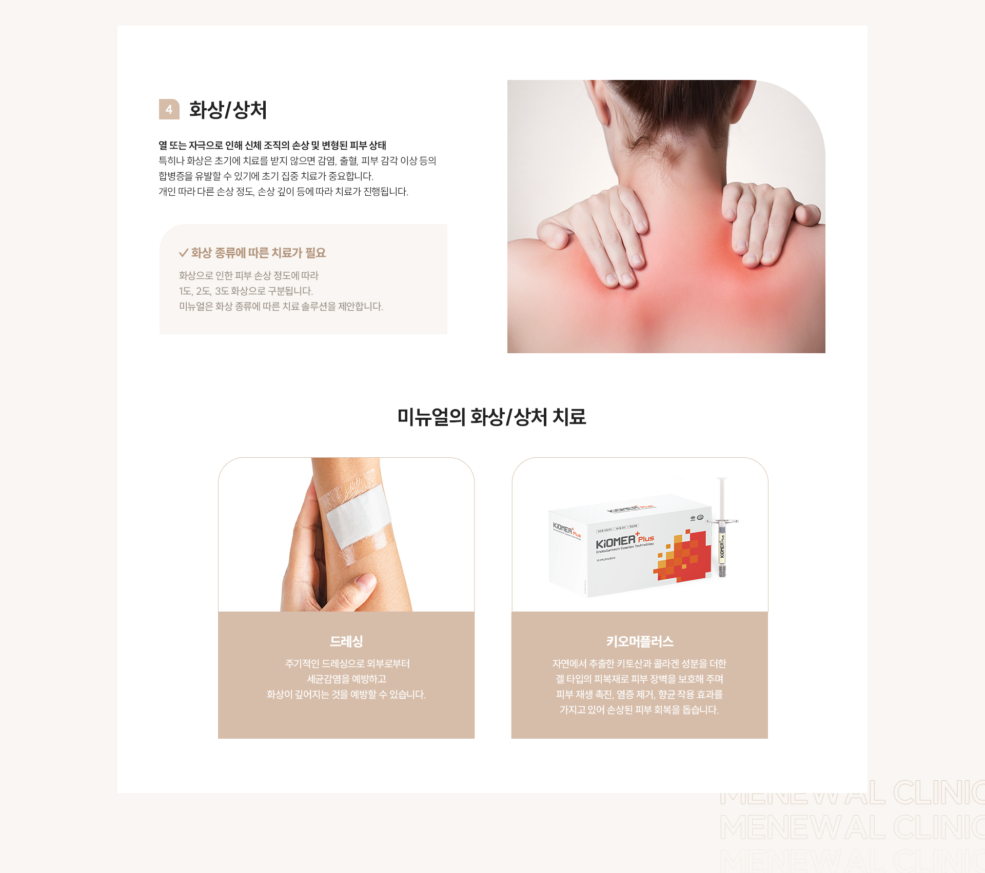 피부질환 체크포인트